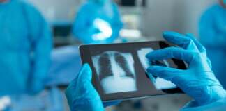 radiografie plamani