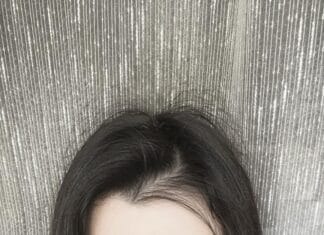 Andreea Alexandra Duduială, din Târgu Jiu, luptă cu o boală autoimună rară