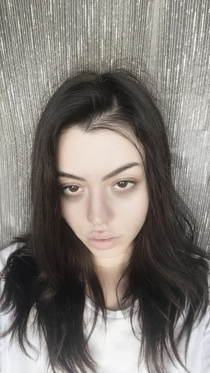 andreea Andreea Alexandra Duduială, din Târgu Jiu, luptă cu o boală autoimună rară